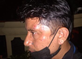 Kecam Aksi Brutal Aniaya Wartawan, Aliansi Pers Minta Pelaku Dipenjarakan