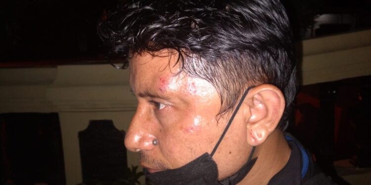 Kecam Aksi Brutal Aniaya Wartawan, Aliansi Pers Minta Pelaku Dipenjarakan