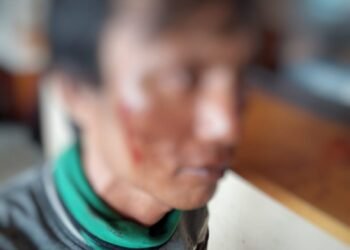 Ricuh Aksi Demo di Nabire, Dua Masyarakat Tak Terlibat Aksi Jadi Korban Penganiayaan Massa