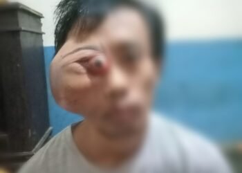 Warga Subang Derita Tumor Harap Kemurahan Hati Dermawan