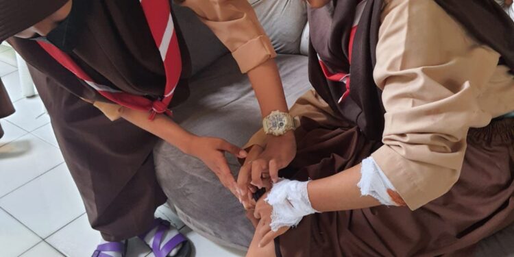 Jalan Menuju SMPN 2 Citeureup Rusak, Dua Siswi Terjatuh Saat Ingin Menuju Kesekolah.