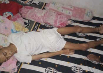 Idap Penyakit Aneh, Warga Padasuka Ciomas Butuh Bantuan Pemerintah dan Dermawan