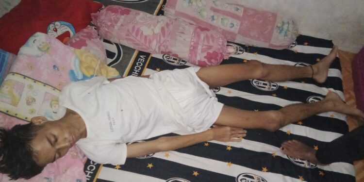 Idap Penyakit Aneh, Warga Padasuka Ciomas Butuh Bantuan Pemerintah dan Dermawan