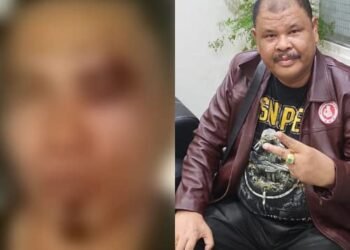 Ketua DPC Ratu Prabu 08 Tapanuli Tengah Dikeroyok, Diduga Disaksikan Mantan Bupati Baktiar Sibarani