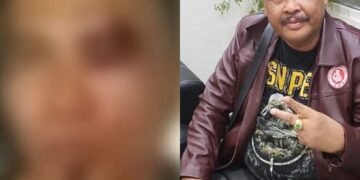 Ketua DPC Ratu Prabu 08 Tapanuli Tengah Dikeroyok, Diduga Disaksikan Mantan Bupati Baktiar Sibarani