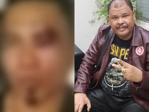 Ketua DPC Ratu Prabu 08 Tapanuli Tengah Dikeroyok, Diduga Disaksikan Mantan Bupati Baktiar Sibarani