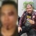 Ketua DPC Ratu Prabu 08 Tapanuli Tengah Dikeroyok, Diduga Disaksikan Mantan Bupati Baktiar Sibarani