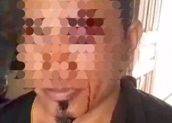 Aktivis Edyanto Simatupang Dikeroyok Gerombolan OTK