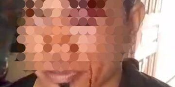 Aktivis Edyanto Simatupang Dikeroyok Gerombolan OTK