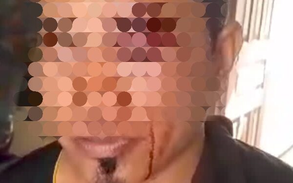 Aktivis Edyanto Simatupang Dikeroyok Gerombolan OTK