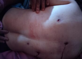 Polisi Berhasil Mengamankan Seorang Pria Terduga Pelaku Penembakan Di Kecamatan Pengkadan, Kabupaten Kapuas Hulu
