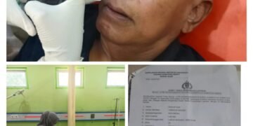 Wartawan Dilindungi oleh UU Mantan Sekda Kab. Agam Harus di Tindak Tegas AWRI : Kawal Kasus Penganiayaan