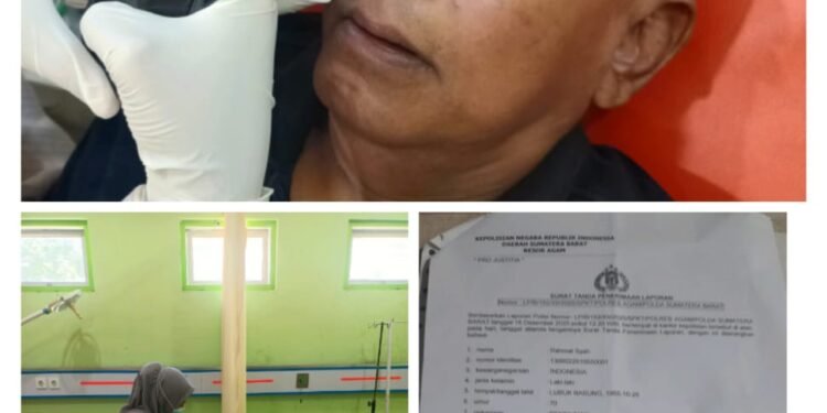 Wartawan Dilindungi oleh UU Mantan Sekda Kab. Agam Harus di Tindak Tegas AWRI : Kawal Kasus Penganiayaan